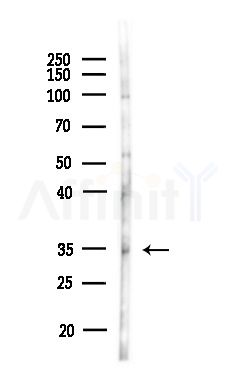 Sarcoglycan beta Antibody - Western blot analysis of lysates from MDA-MB-231 cells(heat-shock,45min treatment), using Sarcoglycan beta Antibody at 1/1000 dilution.