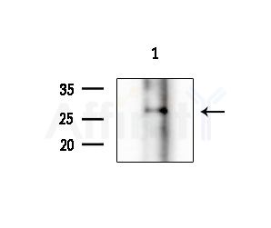 SEI-1 Antibody - Western blot analysis of extracts from COLO205 cells(heat-shock treatment), using SEI-1 Antibody at 1/1000 dilution.