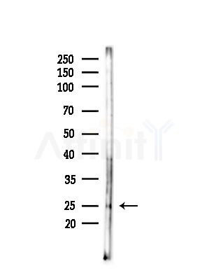 SEI-1 Antibody - Western blot analysis of lysates from COLO205 cells(heat-shock,45min treatment), using SEI-1 Antibody at 1/1000 dilution.