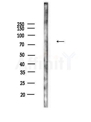 SEMA3A Antibody - Western blot analysis of lysates from Mouse liver, using SEMA3A Antibody at 1/1000 dilution.