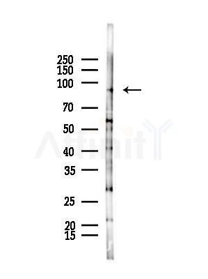 SEMA3F Antibody - Western blot analysis of lysates from B16F10-LUC cells(starvation,24h treatment), using SEMA3F Antibody at 1/1000 dilution.