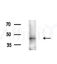 SMYD2 Antibody - Western blot analysis of extracts from EC304 cells
(heat-shock treatment), using SMYD2 Antibody at 1/1000 dilution.