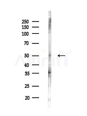SMYD2 Antibody - Western blot analysis of lysates from EC304 cells(heat-shock treatment), using SMYD2 Antibody at 1/1000 dilution.