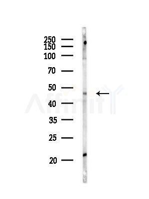 SOX11 Antibody - Western blot analysis of lysates from Raji cells(heat-shock,45min treatment), using SOX11 Antibody at 1/1000 dilution.