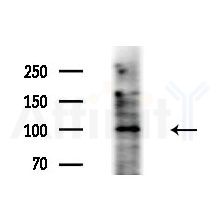 Synphilin-1 Antibody - Western blot analysis of lysates from HepG2 cells(LPS, 4h treatment), using Synphilin-1 Antibody at 1/1000 dilution.