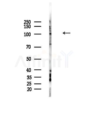 Synphilin-1 Antibody - Western blot analysis of lysates from HepG2 cells(LPS, 4h treatment), using Synphilin-1 Antibody at 1/1000 dilution.