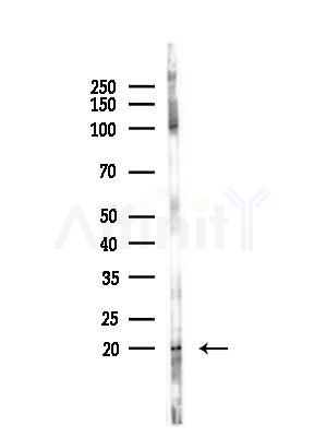 TCR beta Antibody - Western blot analysis of lysates from COLO205 cells(UV,30min treatment), using TCR beta Antibody at 1/1000 dilution.
