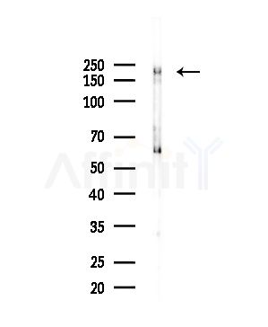 Tensin-1 Antibody - Western blot analysis of lysates from Hela cells(LPS,4h treatment), using Tensin-1 Antibody at 1/1000 dilution.