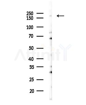 Tensin-1 Antibody - Western blot analysis of lysates from COLO205 cells(heat-shock,45min treatment), using Tensin-1 Antibody at 1/1000 dilution.