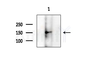 Tensin-2 Antibody - Western blot analysis of extracts from Mouse testis, using Tensin-2 Antibody at 1/1000 dilution.