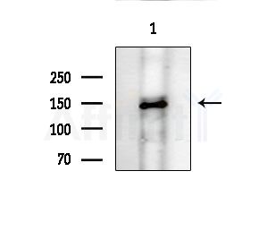 Tensin-2 Antibody - Western blot analysis of extracts from COS-7 cells(heat-shock treatment), using Tensin-2 Antibody at 1/1000 dilution.