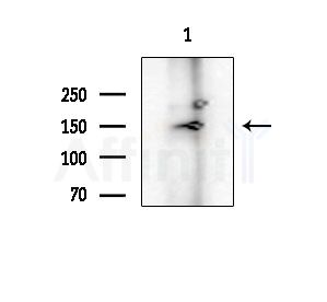 Tensin-2 Antibody - Western blot analysis of extracts from COLO205 cells(heat-shock treatment), using Tensin-2 Antibody at 1/1000 dilution.