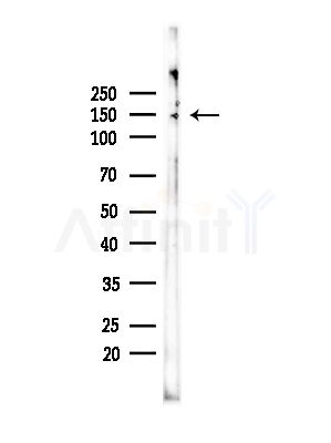 Tensin-2 Antibody - Western blot analysis of lysates from COLO205 cells(heat-shock,45min treatment), using Tensin-2 Antibody at 1/1000 dilution.