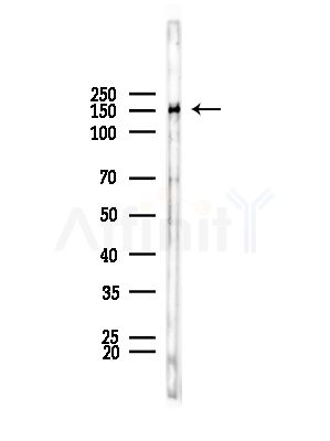 Tensin-2 Antibody - Western blot analysis of lysates from COS-7 cells(heat-shock,45min treatment), using Tensin-2 Antibody at 1/1000 dilution.