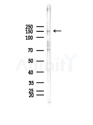 Tensin-2 Antibody - Western blot analysis of lysates from Mouse testis, using Tensin-2 Antibody at 1/1000 dilution.