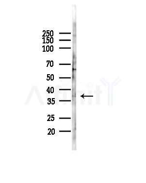Trypsin-3 Antibody - Western blot analysis of lysates from COLO205 cells(heat-shock,45min treatment), using Trypsin-3 Antibody at 1/1000 dilution.