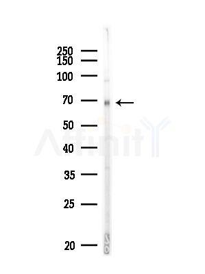 UGT8 Antibody - Western blot analysis of lysates from MDA-MB-231 cells(heat-shock,45min treatment), using UGT8 Antibody at 1/1000 dilution.