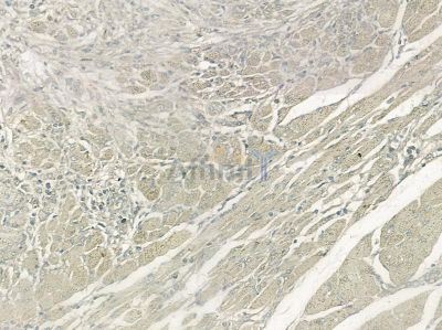 VAMP 1/2/3 Antibody - DF8628 at 1/100 staining rat skin tissue by IHC-P.