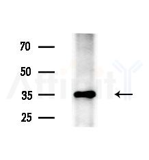 ATP6V0D1 Antibody - Western blot analysis of extracts from HepG2 cells(LPS, 4h treatment), using ATP6V0D1 Antibody at 1/1000 dilution.