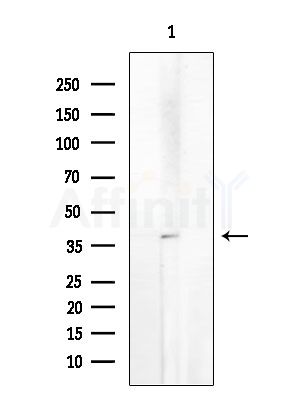 AWAT1 Antibody - Western blot analysis of extracts from EC304 cells, using AWAT1 Antibody at 1/1000 dilution.