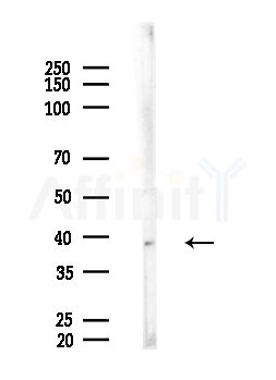 AWAT1 Antibody - Western blot analysis of lysates from EC304 cells, using AWAT1 Antibody at 1/1000 dilution.