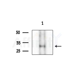C56D2 Antibody - Western blot analysis of extracts from COLO205 cells(heat-shock treatment), using C56D2 Antibody at 1/1000 dilution.
