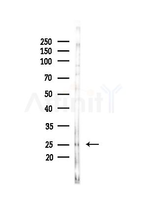 C56D2 Antibody - Western blot analysis of lysates from COLO205 cells(heat-shock,45min treatment), using C56D2 Antibody at 1/1000 dilution.