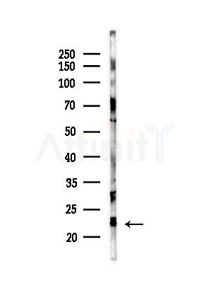 Cofilin Antibody - Western blot analysis of lysates from Hela cells(starvation,24h treatment), using Cofilin Antibody at 1/1000 dilution.