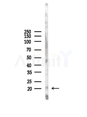 Cofilin Antibody - Western blot analysis of lysates from LoVo cells(heat-shock,45min treatment), using Cofilin Antibody at 1/1000 dilution.