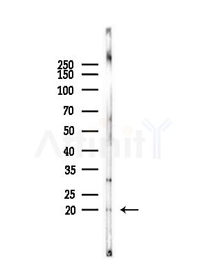 Cofilin Antibody - Western blot analysis of lysates from Rat lung, using Cofilin Antibody at 1/1000 dilution.