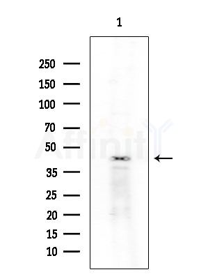 ELAV2/4 Antibody - Western blot analysis of extracts from COLO205 cells(heat-shock treatment), using ELAV2/4 Antibody at 1/1000 dilution.