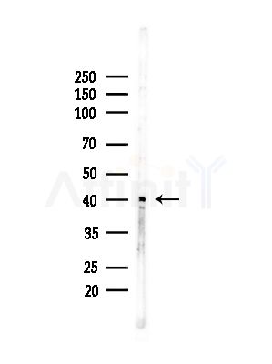 ELAV2/4 Antibody - Western blot analysis of lysates from COLO205 cells(heat-shock,45min treatment), using ELAV2/4 Antibody at 1/1000 dilution.