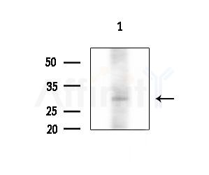 ELF5 Antibody - Western blot analysis of extracts from 293 cells(starvation treatment), using ELF5 Antibody at 1/1000 dilution.