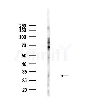 ELF5 Antibody - Western blot analysis of lysates from 293 cells(starvation,24h treatment), using ELF5 Antibody at 1/1000 dilution.