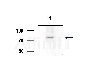 FAKD2 Antibody - Western blot analysis of extracts from COLO205 cells(heat-shock treatment), using FAKD2 Antibody at 1/1000 dilution.