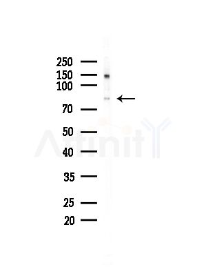 FAKD2 Antibody - Western blot analysis of lysates from COLO205 cells(heat-shock,45min treatment), using FAKD2 Antibody at 1/1000 dilution.