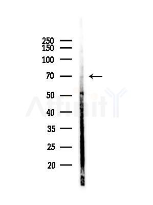 GAS6 Antibody - Western blot analysis of lysates from MDA-MB-231 cells(heat-shock,45min treatment), using GAS6 Antibody at 1/1000 dilution.