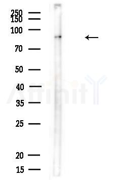 GIT1 Antibody - Western blot analysis of lysates from Rat liver, using GIT1 Antibody at 1/1000 dilution.
