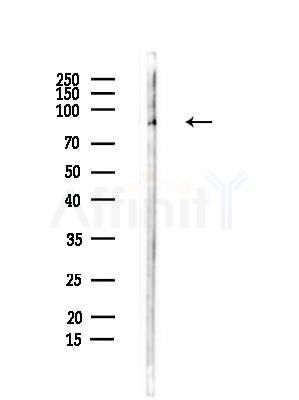 GIT1 Antibody - Western blot analysis of lysates from Hela cells(heat-shock,45min treatment), using GIT1 Antibody at 1/1000 dilution.