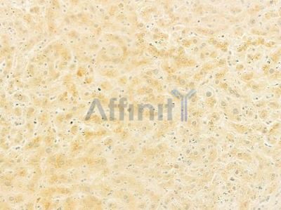 GIT1 Antibody - DF8660 at 1/100 staining human normal liver tissue by IHC-P.
