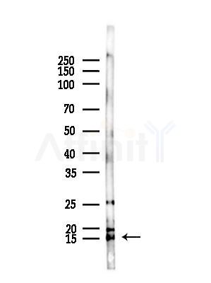 Histone H2B Antibody - Western blot analysis of lysates from B16F10-LUC cells(starvation,24h treatment), using Histone H2B Antibody at 1/1000 dilution.