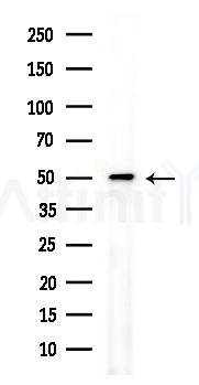 hnRNP H Antibody - Western blot analysis of extracts from PC12 cells(LPS,4h treatment), using hnRNP H Antibody at 1/1000 dilution.