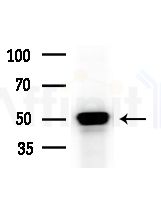 hnRNP H Antibody - Western blot analysis of extracts from HepG2 cells(heat-shock treatment), using hnRNP H Antibody at 1/1000 dilution.