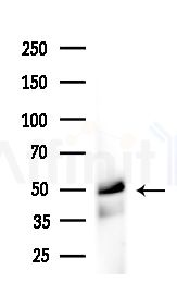 hnRNP H Antibody - Western blot analysis of extracts from Mouse liver, using hnRNP H Antibody at 1/1000 dilution.