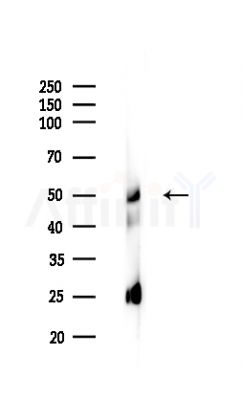 hnRNP H Antibody - Western blot analysis of lysates from Mouse liver, using hnRNP H Antibody at 1/1000 dilution.