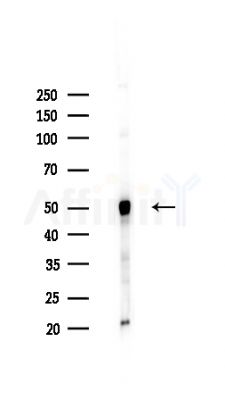 hnRNP H Antibody - Western blot analysis of lysates from HepG2 cells(heat-shock,45min treatment), using hnRNP H Antibody at 1/1000 dilution.