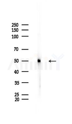 hnRNP H Antibody - Western blot analysis of lysates from Rat brain, using hnRNP H Antibody at 1/1000 dilution.