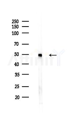 hnRNP H Antibody - Western blot analysis of lysates from PC12 cells(LPS,4h treatment), using hnRNP H Antibody at 1/1000 dilution.