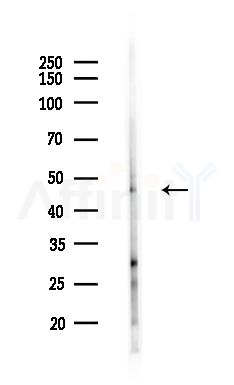 IP6K2 Antibody - Western blot analysis of lysates from HepG2 cells(heat-shock,45min treatment), using IP6K2 Antibody at 1/1000 dilution.