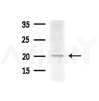 JTB Antibody - Western blot analysis of extracts from HepG2 cells(heat-shock,45min treatment), using JTB Antibody at 1/1000 dilution.